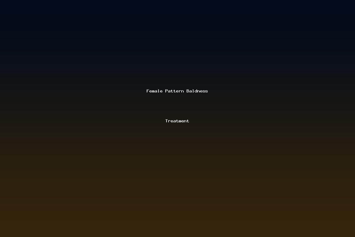 Female Pattern Baldness Treatment